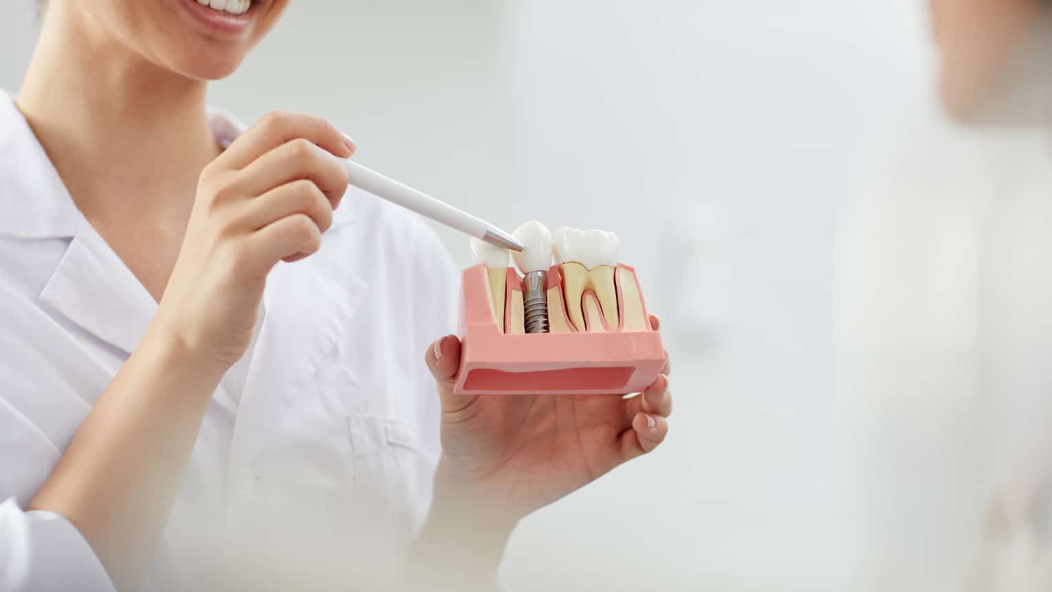 Types of Dental Implants: Which One is Right for You?